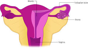 types of ovarian cancer target ovarian cancer