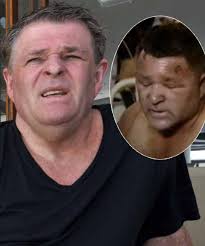 Bali Bombing Survivor Peter Hughes: 'I Thought A Gas Main Had Exploded'