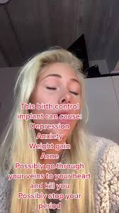 Nexplanon is my best friend