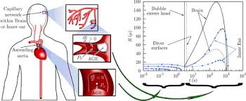 Image result for Inner Ear Decompression Sickness