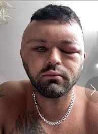 A man from Lancashire is urging...