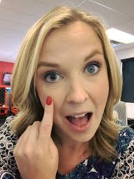 So this is what happens when you get decked in the eyeball with a champagne  cork. 👁🍾 Careful kids, alcohol is dangerous. And no worries, the doc said  everything should heal just