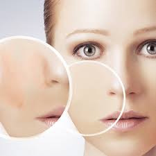 Cilt Lekeleri Dermatolog Doktor Oyku Celen