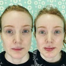 Dani J Sher PA-C @sparkleaestheticsoakpark (@dani_sparkle_pa) · Oak Park, IL