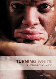 Turning white : a memoir of change : Thomas, Lee, 1967- : Free Download,  Borrow, and Streaming : Internet Archive