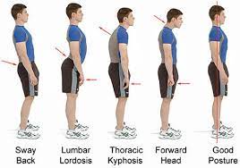 Bad posture can have very damaging effects on your physical health (joint problems, fatigue, headaches, etc) not to what can you do to fix the problem? 4 Signs Of Terrible Posture And How To Fix It Coastal Urgent Care Louisiana