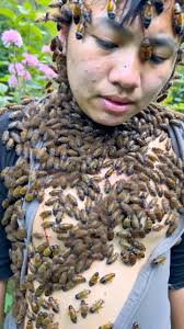 Did you know about bee's therapy?