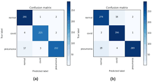 Puoi convertire euros in altre valute diverse con il modulo nella barra laterale destra. Focuscovid Automated Covid 19 Detection Using Deep Learning With Chest X Ray Images Springerlink