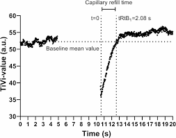 Image result for Capillary Refill