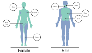 Certain skin conditions or health issues can make using ipl unsuitable for individuals. Laser Hair Removal Montrose Dermatology And Cosmetics