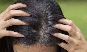 Trichotillomania is characterized by an overwhelming urge to repeatedly pull out one's own hair, resulting in repetitive hair pulling and subsequent hair loss. All You Wanted To Know About Grey Hair And Grey Hair Treatment