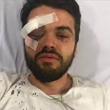 Detuvieron a cinco jóvenes que le dieron una paliza al rugbier gay