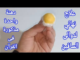 قد ينصح الطبيب مريض دوالي الساقين بارتداء جوارب خاصة، حيث تضع هذه الجوارب ضغطاً كافياً على ساقيه حتى يتدفق الدم بسهولة باتجاه. Ø£Ù‚Ø³Ù…Øª Ø¨Ø±Ø¨Ù‡Ø§ Ø¯Ù‡Ù†Ø© ÙˆØ§Ø­Ø¯Ø© Ù‚Ø¨Ù„ Ø§Ù„Ù†ÙˆÙ… Ø®Ù„ØµØªÙ‡Ø§ Ù…Ù† Ø¯ÙˆØ§Ù„Ù‰ Ø§Ù„Ø³Ø§Ù‚ÙŠÙ† ÙˆØ§Ù„Ø£ÙˆØ±Ø¯Ø© Ø§Ù„Ø¹Ù†ÙƒØ¨ÙˆØªÙŠØ© Ù†Ù‡Ø§Ø¦ÙŠØ§ Ù…Ø°ÙƒÙˆØ±Ø©ÙÙ‰ Ø§Ù„Ù‚Ø±Ø¢Ù† Youtube