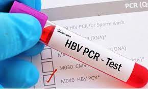 15335الفيديو ده بيجاوب علي اسئلة عن تحليل ال pcr ايه. Ù…Ø§ Ù‡Ùˆ ÙØ­Øµ Pcr Ø§Ù„Ø°ÙŠ Ù†Ø³Ù…Ø¹ Ø¹Ù†Ù‡ ÙƒØ«ÙŠØ± Ø§ Ø¹Ù†Ø¨ Ø¨Ù„Ø¯ÙŠ