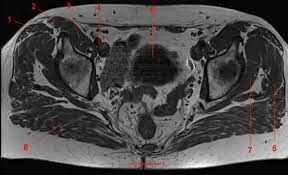 Maybe you would like to learn more about one of these? Mri Of The Hip Detailed Anatomy W Radiology
