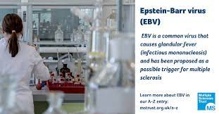 Maybe you would like to learn more about one of these? Epstein Barr Virus Ms Trust