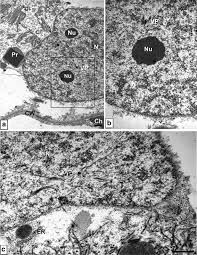 Maybe you would like to learn more about one of these? The Participation Of Plant Cell Organelles In Compatible And Incompatible Potato Virus Y Tobacco And Potato Plant Interaction Springerlink