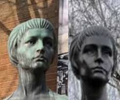 Darcey and Stacey's plastic surgery transformations