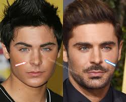 Zac efron shocked fans when he appeared to debut a new look — but did he get plastic surgery on his face? Zac Efron Before And After 2020