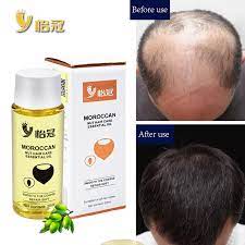 Whether applied directly to the scalp or you use argan oil for styling hair, the vitamin e that it contains is a great moisturizer. Argan Oil Hair Care Treatment Essence Fast Powerful Hair Growth Liquid Hair Loss Products Serum Repair Hair Keratine Herbal 20ml