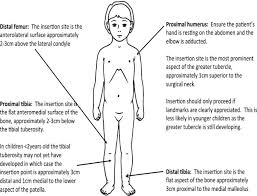 Image result for Difficult Intravenous Access in Children