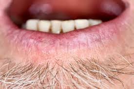 Image result for Oncinotis