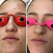 Dana Point Acne Lab & Skincare Studio