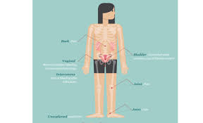 Call your doctor or 911 if you think you may have a medical. 6 Signs And Symptoms Of Cervical Cancer In Women Medanta