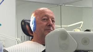 A BCC leads to major surgery and a prosthetic ear