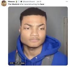 The international clearinghouse of plastic surgery meetings calendar is prepared by asps and the international clearinghouse of meetings calendar is designed to reduce overlaps and provide a service for plastic surgery and related asps plastic surgery coding workshop 2021. The Weeknd S Plastic Surgery All You Need To Know