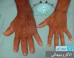 تعرف أشرف اللى فى مسلسل الكبير أوى ايوة Grow Up Your Mind Medical فيسبوك