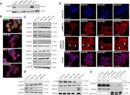 Dapk1 Loss Triggers Tumor Invasion In Colorectal Tumor Cells