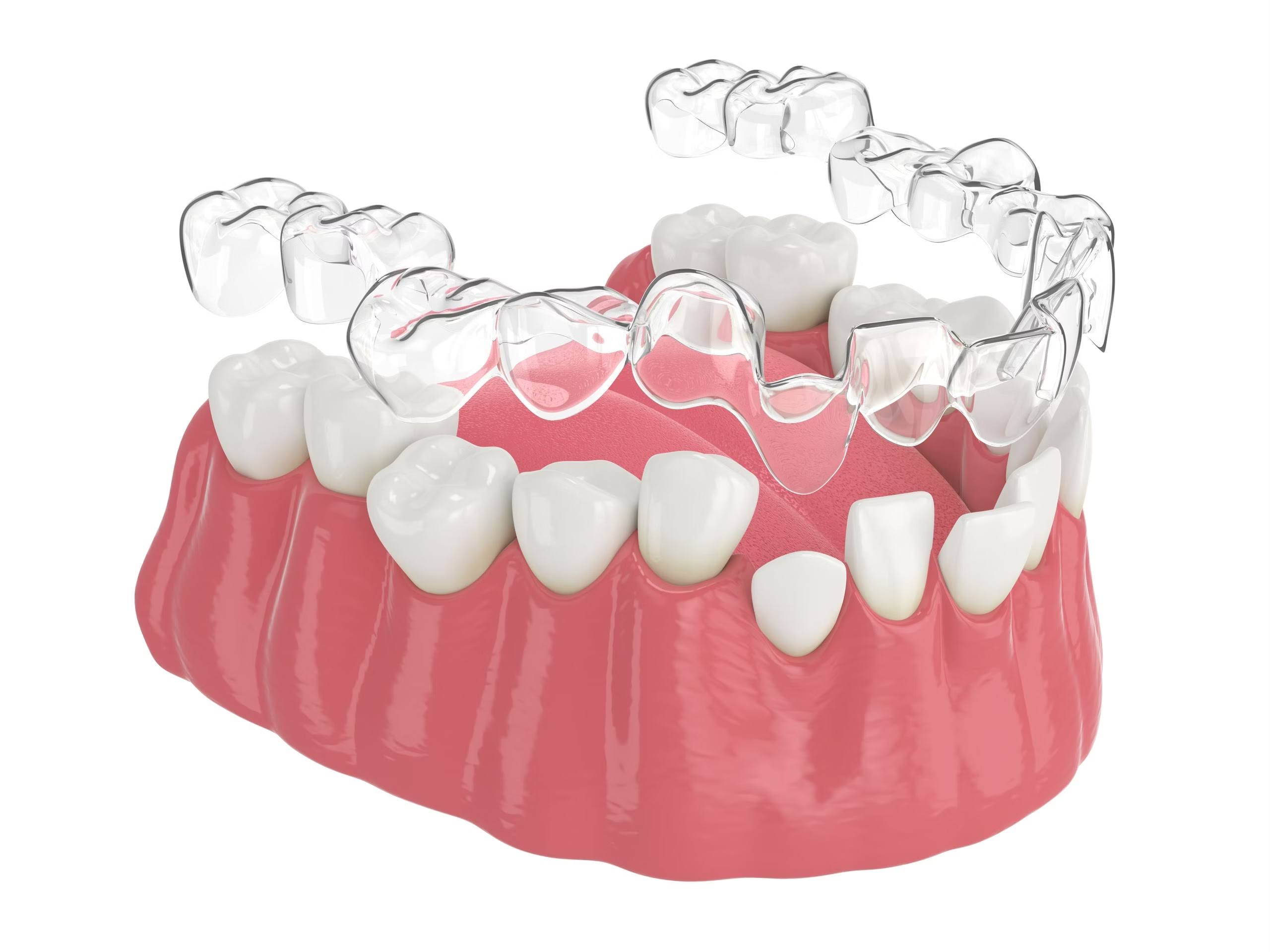 TEETH INVISIBLE ALIGNERS product image