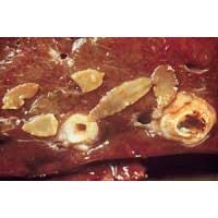 Liver fluke as discussed earlier in this guide liver fluke in sheep can be acute, subacute or chronic liver fluke has over the years become more widespread; Liver Fluke G Shepherd Animal Health