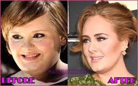 Maybe you would like to learn more about one of these? Pin By Diana Chang On Celebs In 2021 Nose Job Plastic Surgery Celebrity Plastic Surgery