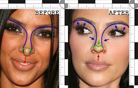 Pin By K La Chic On Funky Shoes Kardashian Plastic Surgery Plastic Surgery Nose Job