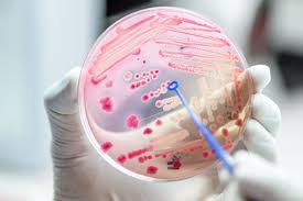 Image result for Group B Streptococcus Prophylaxis