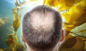 Several of the minerals in sea kelp along with iodine will promote a healthier scalp and stronger hair. Hair Loss Treatment Seaweed Contains Important Properties Known To Help With Hair Growth Express Co Uk