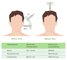 Image result for Tuning Fork Test