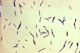 Listeria monocytogenes is a ubiquitous microorganism responsible for listeriosis, a rare but severe disease in humans, who can become infected by ingesting contaminated food products, namely dairy. Medizinische Mikrobiologie Grampositive Stabchen Wikibooks Sammlung Freier Lehr Sach Und Fachbucher