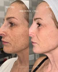 These posts make me so happy and proud! Knowing that we are changing lives  and working