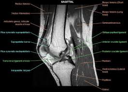 Anterior Cruciate Ligament Injury Knee Mri Cruciate Ligament Cruciate Ligament Injury