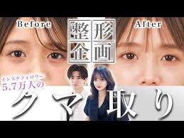 Quick Dark Circle Removal