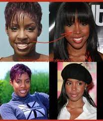 Nose job or rhinoplasty is the most common and used practice amongst all the plastic surgeries. Why Do People Never Talk About Kelly Rowland Nose Job Lipstick Alley