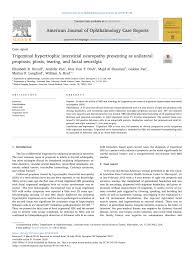 From treating eye diseases and offering the latest in eye surgery to providing eye exams. Pdf Trigeminal Hypertrophic Interstitial Neuropathy Presenting As Unilateral Proptosis Ptosis Tearing And Facial Neuralgia