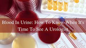 Seeing blood in your urine can be alarming. Blood In Urine How To Know When It S Time To See Urologist