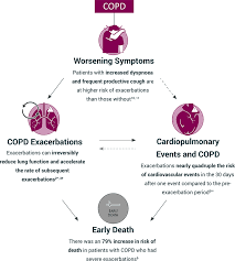 Image result for COPD Exacerbation Prevention