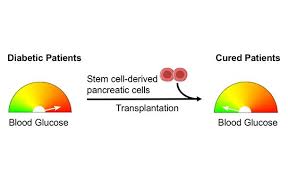 Lian Receives Engine Grant For Stem Cell Based Diabetes