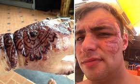 By emotionally paying tribute to the wrong sibling. Four In Five Bali Henna Tattoo Artists Use Chemical That Can Cause Permanent Scars Daily Mail Online