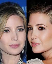 Ivanka Trump Nose Job